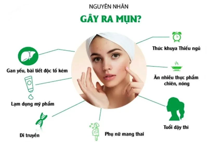 Mụn hình thành do nguyên nhân gì