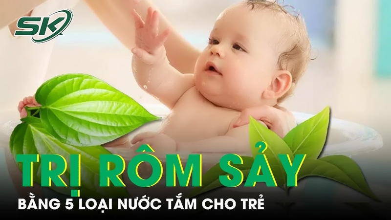 Sữa tắm trị rôm sảy cho bé - Nguyên nhân, triệu chứng, lưu ý